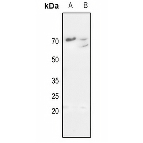MMP11 Rabbit Polyclonal Antibody