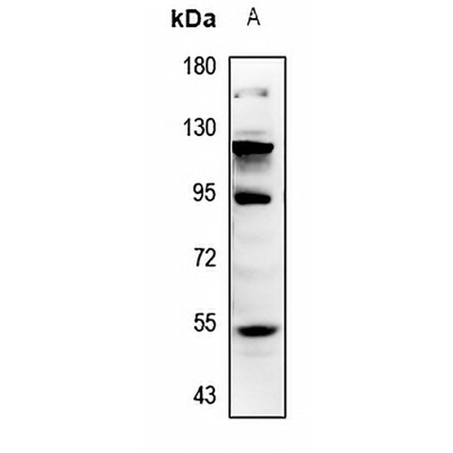 MMP12 Rabbit Polyclonal Antibody