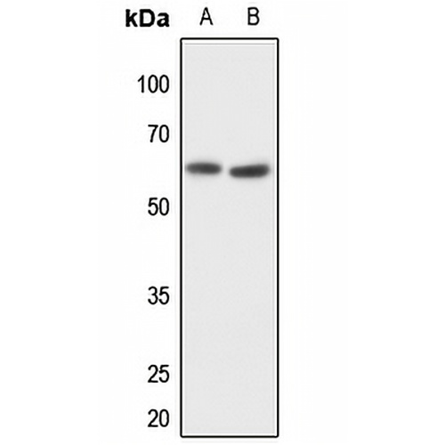 MMP14 Rabbit Polyclonal Antibody
