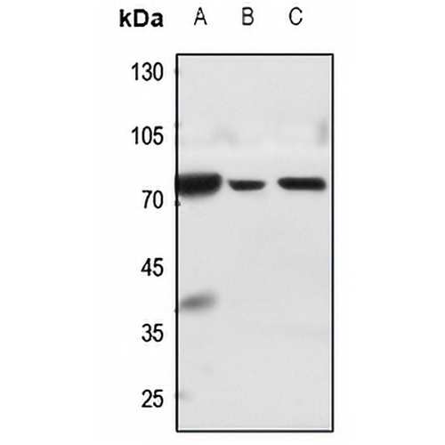 MMP15 Rabbit Polyclonal Antibody
