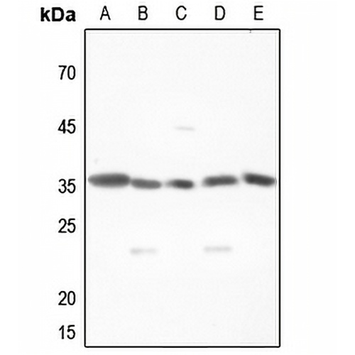 MNAT1 Rabbit Polyclonal Antibody