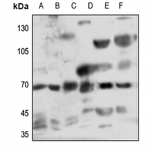 Myotubularin Rabbit Polyclonal Antibody
