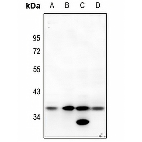 MT-ND1 Rabbit Polyclonal Antibody