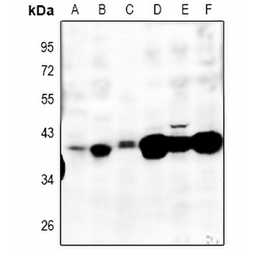 MT-ND2 Rabbit Polyclonal Antibody