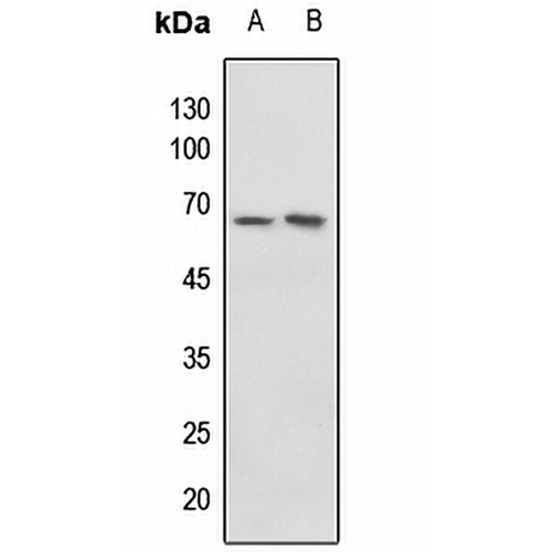 c-Myc (Phospho-T58) Rabbit Polyclonal Antibody