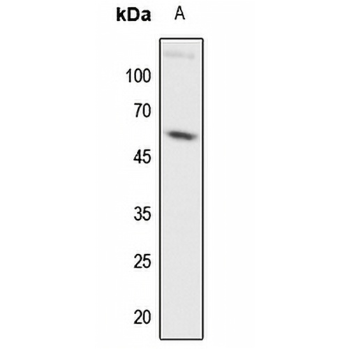 c-Myc Rabbit Polyclonal Antibody