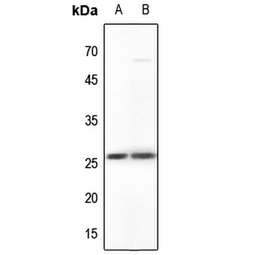 MYF5 Rabbit Polyclonal Antibody