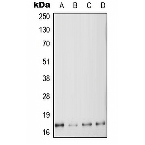 MYL6 Rabbit Polyclonal Antibody
