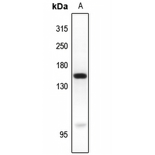MYO6 Rabbit Polyclonal Antibody