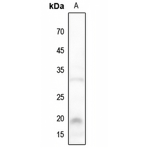 NBL1 Rabbit Polyclonal Antibody