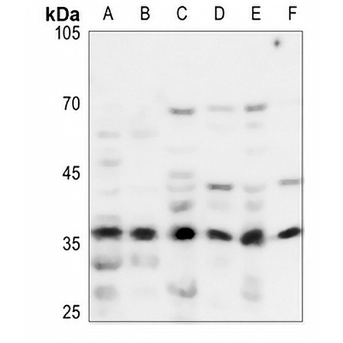NDUFA9 Rabbit Polyclonal Antibody