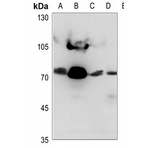 NDUFS1 Rabbit Polyclonal Antibody
