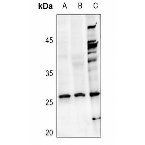NDUFV2 Rabbit Polyclonal Antibody