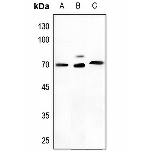 NEFL Rabbit Polyclonal Antibody