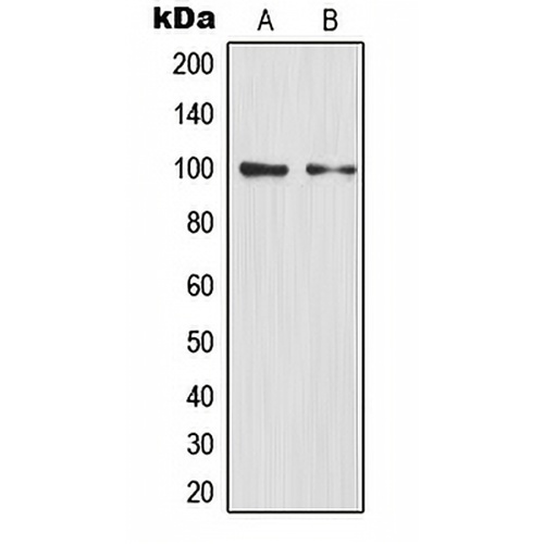 NF-kappaB p100 Rabbit Polyclonal Antibody