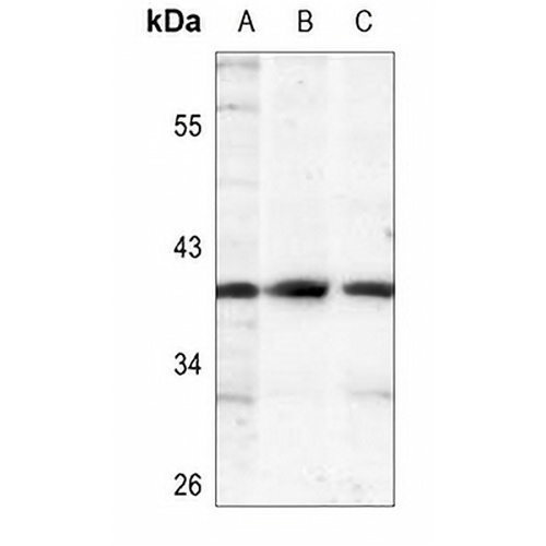 IKB alpha (Phospho-S32/S36) Rabbit Polyclonal Antibody