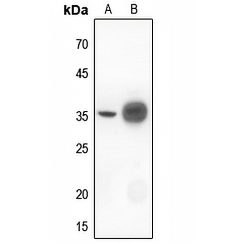 IKB alpha Rabbit Polyclonal Antibody
