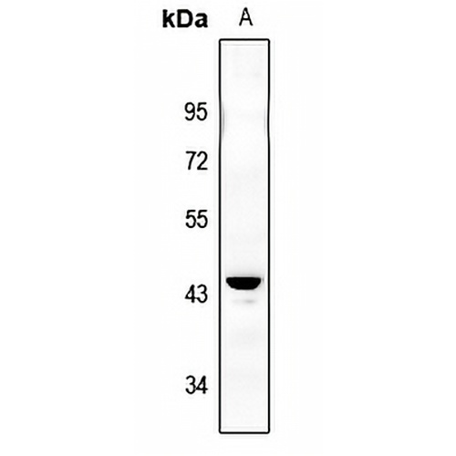 IKB beta (Phospho-S23) Rabbit Polyclonal Antibody