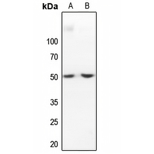 IKB beta Rabbit Polyclonal Antibody