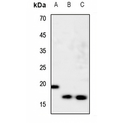 nm23-H1 Rabbit Polyclonal Antibody