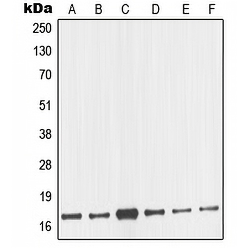 nm23-H2 Rabbit Polyclonal Antibody