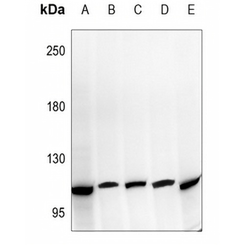 NOTCH2 Rabbit Polyclonal Antibody