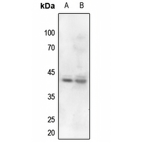 Nucleophosmin (Phospho-T199) Rabbit Polyclonal Antibody