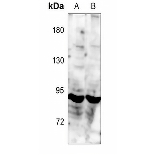 TRK C Rabbit Polyclonal Antibody
