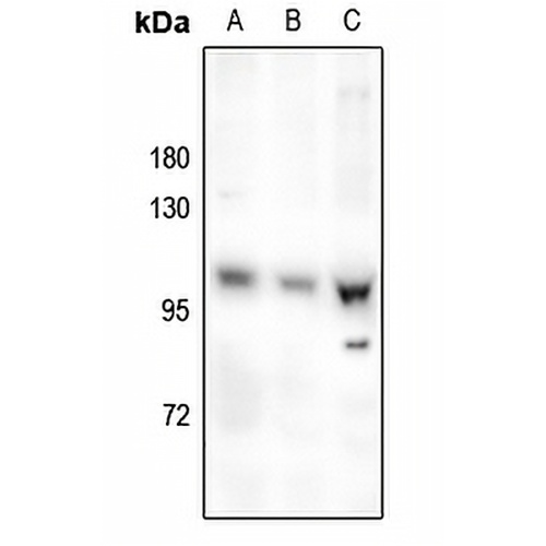 OCRL Rabbit Polyclonal Antibody