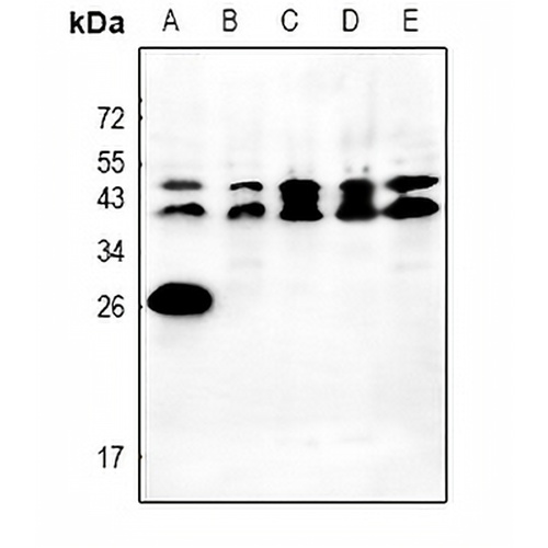 Orosomucoid 2 Rabbit Polyclonal Antibody