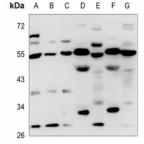 P2X1 Rabbit Polyclonal Antibody