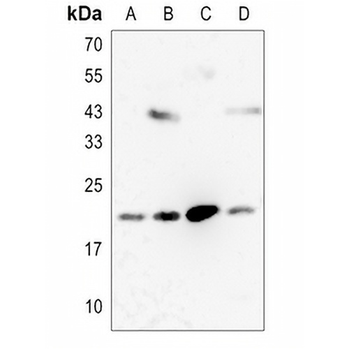 RKIP Rabbit Polyclonal Antibody