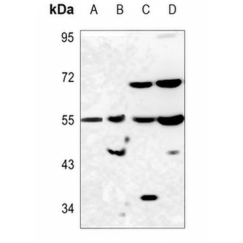 PAH Rabbit Polyclonal Antibody