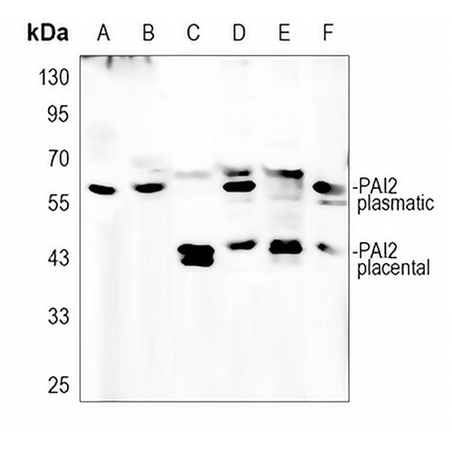 PAI2 Rabbit Polyclonal Antibody