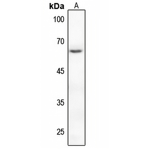 PAK2 (Phospho-S20) Rabbit Polyclonal Antibody
