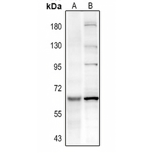 PAK3 (Phospho-S154) Rabbit Polyclonal Antibody