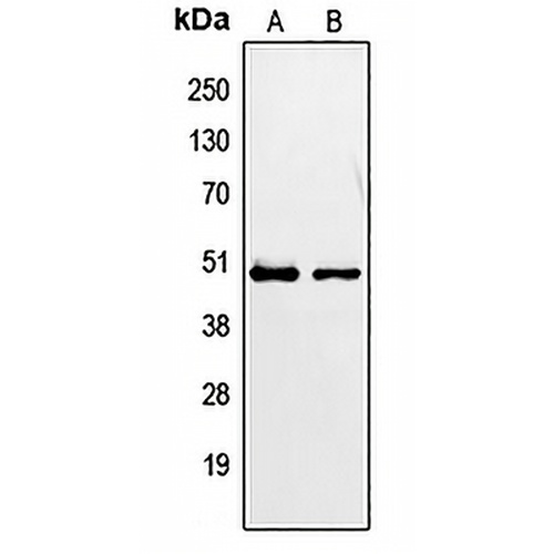 PAX2 Rabbit Polyclonal Antibody