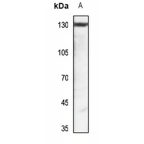Pyruvate Carboxylase Rabbit Polyclonal Antibody