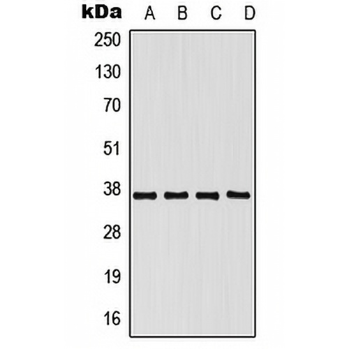hnRNP E1 Rabbit Polyclonal Antibody