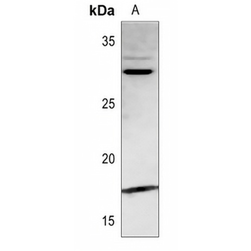 PDGFA Rabbit Polyclonal Antibody