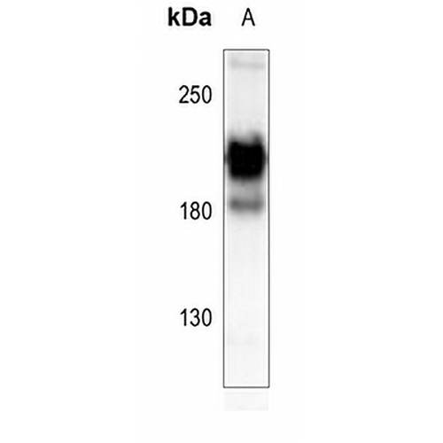 PDGFR alpha Rabbit Polyclonal Antibody