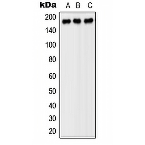 PDGFR beta Rabbit Polyclonal Antibody