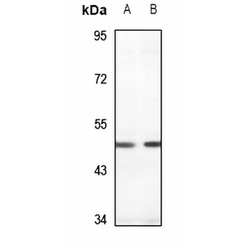 PDK1 Rabbit Polyclonal Antibody