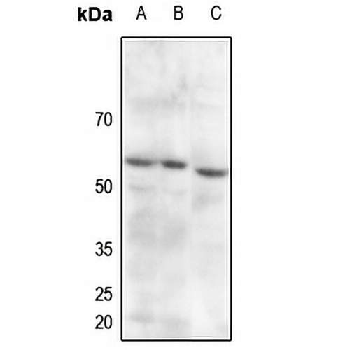 PDPK1 (Phospho-S241) Rabbit Polyclonal Antibody