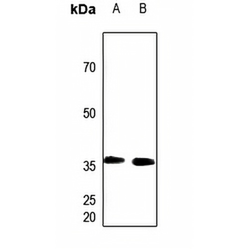 PEX7 Rabbit Polyclonal Antibody