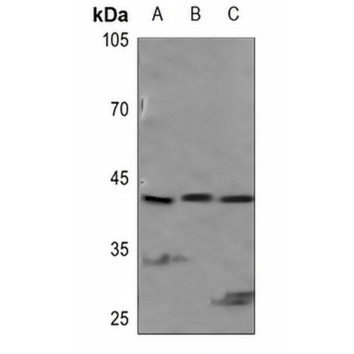 PEX14 Rabbit Polyclonal Antibody