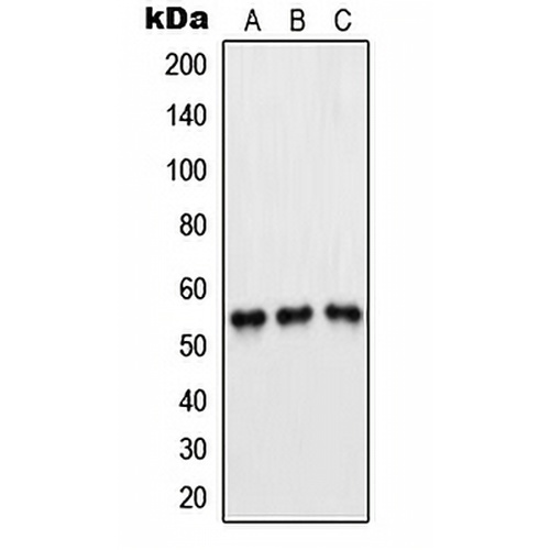 PFKFB1/4 Rabbit Polyclonal Antibody