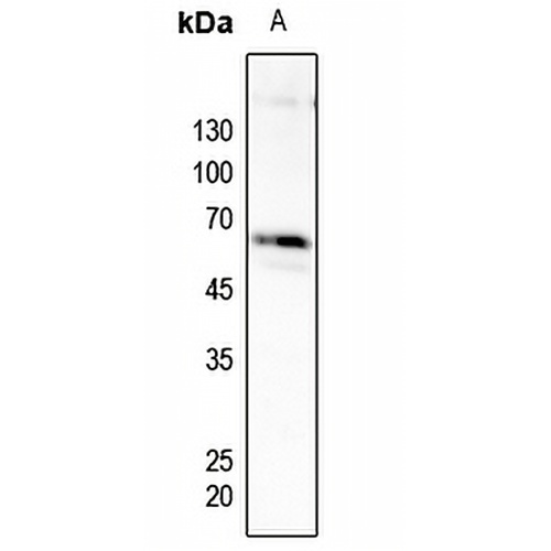 PFKFB2 (Phospho-S483) Rabbit Polyclonal Antibody