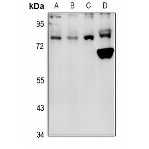 PFKL Rabbit Polyclonal Antibody