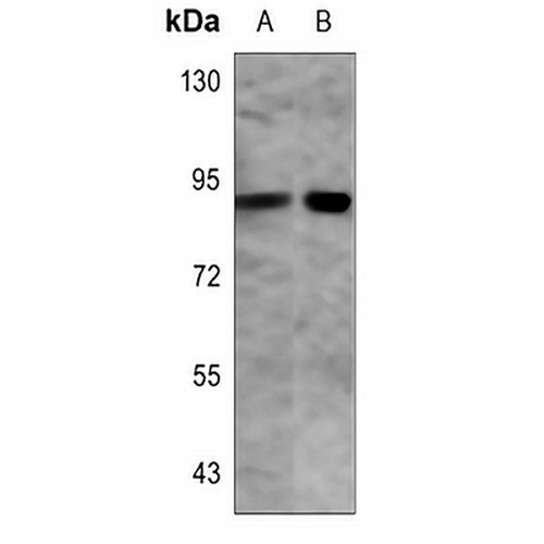PFKP Rabbit Polyclonal Antibody